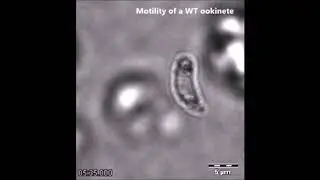Essential role of Plasmodium perforin-like protein 4 in ookinete midgut passage