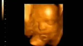 Baby Ryan at 27 weeks
