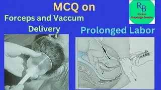 MCQ on Forceps delivery#Vacuum delivery and Prolonged Labor #RB MCQ Bank Knowledge Booster