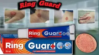 Ring guard cream ke fayade | ring guard cream uses in hindi | Dad khujli ki cream  | Ringguard