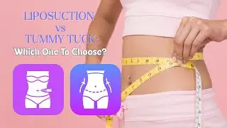 Liposuction VS Tummy Tuck: Which Option To Choose? #bodycontouring #fatloss #cosmeticsurgery