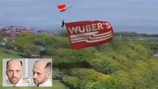 Wuber's Protesi Capelli senza chirurgia