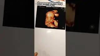 Doppler Scan Baby Growth Weight Check🤰 | Week 33💫 #pregnancy