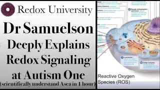 Dr Sameulson   Redox Signaling Explanation   Autism One