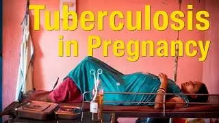 Tuberculosis in Pregnancy: Data, Diagnoses & Drug Resistance