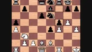Einoris vs Garry Kasparov, 1975 Baku