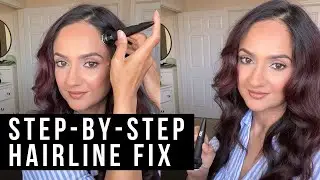 How to Regrow Your Hairline Naturally (Step by Step Routine)