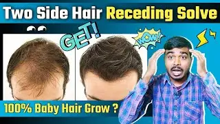 बालों का झरना कैसे रोके? Effective Solution of Receding Hairline | Baby Hair Grow Quick Hairstyle Tv