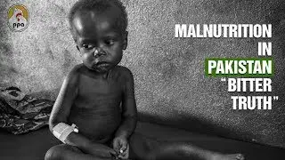 MALNUTRITION IN PAKISTAN &ndash; BITTER TRUTH
