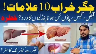 10 Foods that Can Damage your Liver | Hijama Clinic Chakwal
