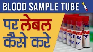 How to labels blood samples must include the following!! health