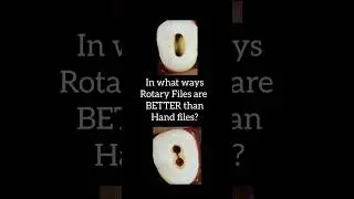 Rotary files VS Hand files