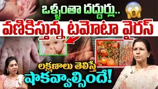 వణికిస్తున్న కొత్త వైరస్..! Tomato Flu Symptoms | Tomato Virus Outbreak In Madhya Pradesh | WWT