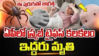 Scrub Typhus Disease Symptoms : ఏపీలో స్క్రబ్ టైఫస్ కలకలం | AP Scrub Typhus Updates | SumanTV Sai
