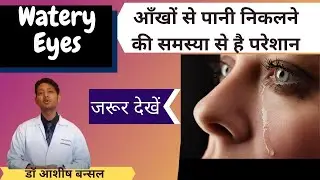 how to stop watery eyes | Watery Eyes |आंखों की Allergy के लिए क्या करें | Dry Eyes| Eye Infection