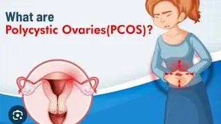 PCOD ll POLYCYSTIC OVARIAN DISEASE ll Mensuration problem #shortvideo #communityhealthnursing...