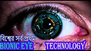 The Worlds First Bionic Eye Bangla 2021 #bioniceye #2021