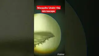 mosquito under the microscope #shorts #mosquito