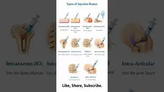 Types of Injection Routes 💉 | IM, IV, SC | Nursing & Medical #injection #type #shorts #viral