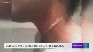 Mom sues Waco school after child returns from field trip with rope burns on neck