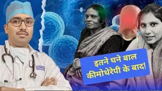 कीमोथेरेपी और इतने घने बाल! Patient Feedback after Chemotherapy 