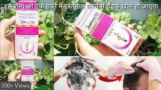 Anaboom AD Shampoo Review | Itchy Scalp & Dandruff Solution