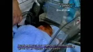 EMBRIONES CONGELADOS Nacen Mellizos Periodista Edgardo Miller Parte II Nuevediario.
