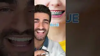 Braces Color Guide?! #shorts