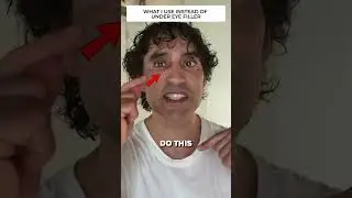 DISSOLVING MY UNDER EYE FILLER REACTION