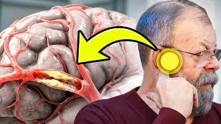 ПОКАЗЫВАЮ КАК БЫСТРО ОЧИСТИТЬ СОСУДЫ МОЗГА 5 УПРАЖНЕНИЯМИ