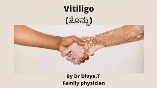 Vitiligo|ತೊನ್ನು|DrDivyaT