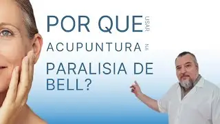 Acupuntura para Paralisia de Bell