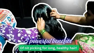 &ldquo;5 Powerful Benefits of Nit Picking for Long, Healthy Hair!&rdquo;