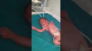 NICU 🥰🥳 SNCU || TOUR|| Neonatal. intensive Care unit || Special newborn Care unit#hospital #shorts