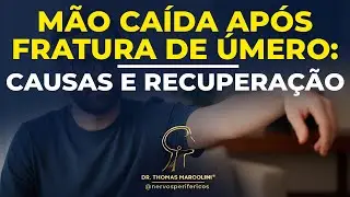 Nervo Radial: Mão caída após Fratura de úmero!
