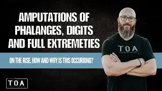 Amputation of Phalanges, Digits & Full Extremities is on the RISE!! - How & Why is the Occurring?