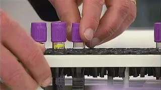 Un nouveau test pour mieux dépister le cancer de la prostate - science