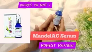 MandelAC Serum Complete & Honest Review || How To Use ||Side Effects