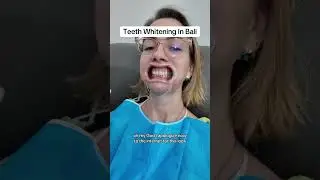 Teeth Whitening in Bali: Cost, Pain & Best Clinics