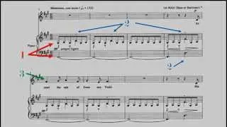 (Part 1/20) - Sondheim's 