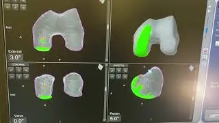 MAKO UNI PKR VIDEO
