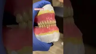 Denture waxup Dentistry Dental Technology #dentistryworld #dentaltechnician