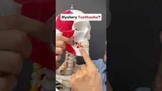 Загадочная зубная боль? Возможно, это мышца! #tmj