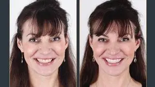 Behind the Scenes: Look inside the Dental Center (Dutch version)