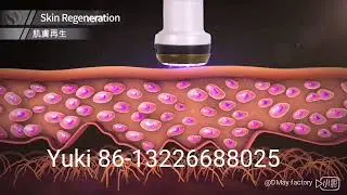 Plasma bt