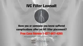 IVC Blood Clot Filter Placement Lawsuit | Inferior Vena Cava Complication Lawsuits