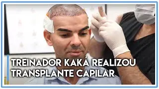 Treinador Kaká realizou transplante capilar na HAIR OF ISTANBUL