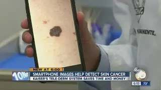 Smartphone images help detect skin cancer