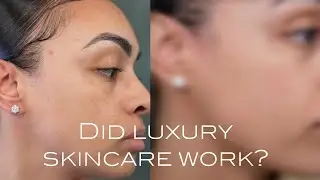 Is Luxury Skincare Worth It? Final Thoughts After 1 Month