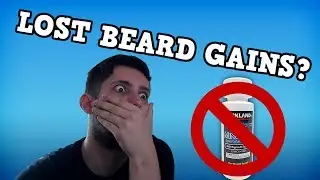 Minoxidil Beard Journey: I Took A Break...